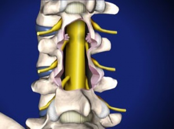 Spine Care of San Antonio Michael S McKee, MD - Back Pain San Antonio Our Mission at Spine Care of San Antonio is to evaluate, diagnose and provide a treatment plan for patients with acute and chronic pain, achieving a reduction or complete resolution of their pain. Spine Care of San Antonio, Michael S