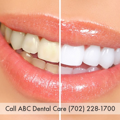 ABC Dental Care